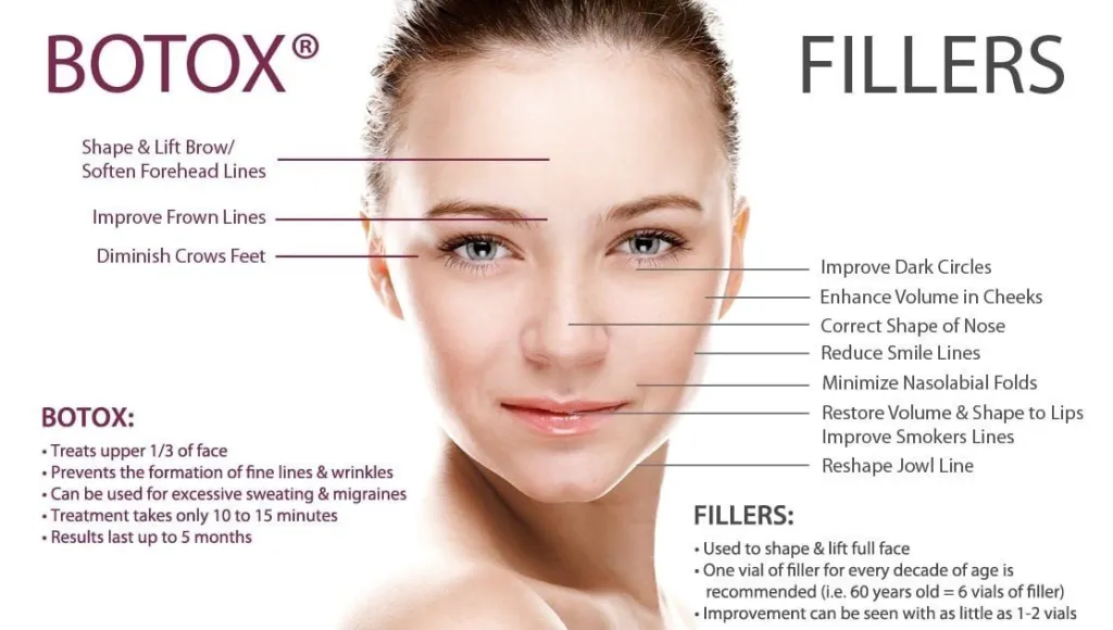 botox and filler information